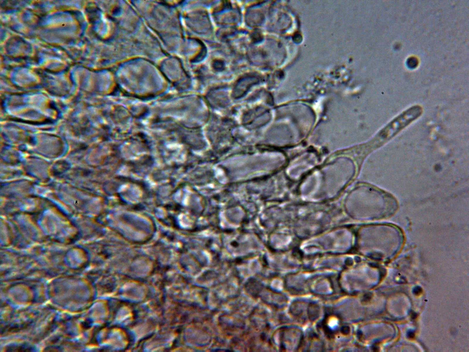 Microscopía de Melanoleuca humilis - 10 - Queilocistidio 4